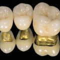 Ducera (Golden-Gate) crown