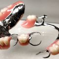Metal Chrome Cobalt Dentures