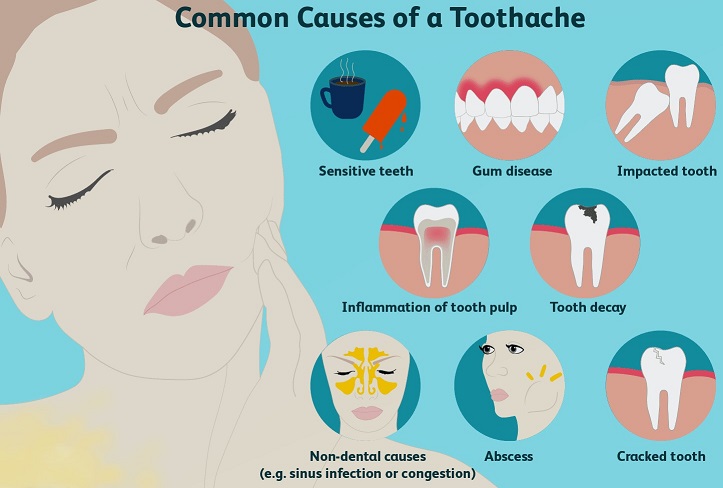 common%20causes%20of%20toothache%202